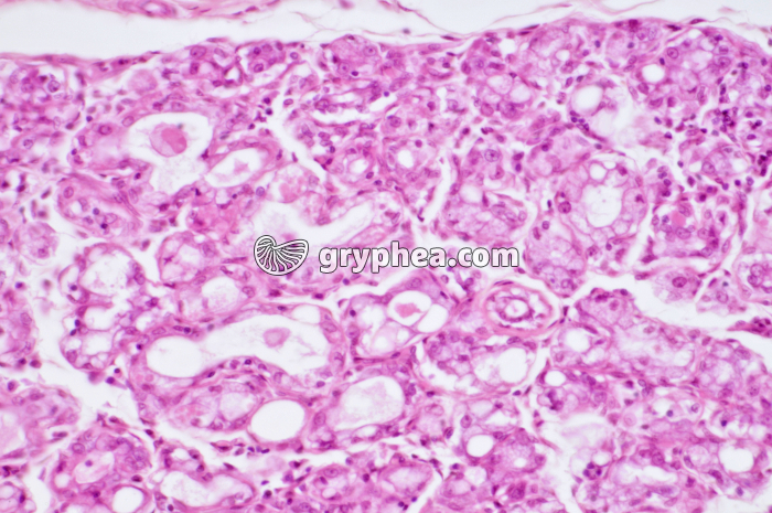 Glande mammaire active CT x40 - gryphea.com